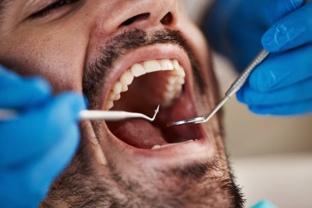 Best Urgent Care for Lost Fillings or Crowns in Lee Acres, NM